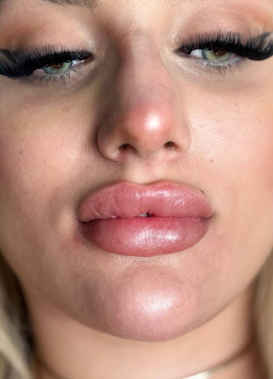 Vor der Mikropigmentierung, Majida Glam