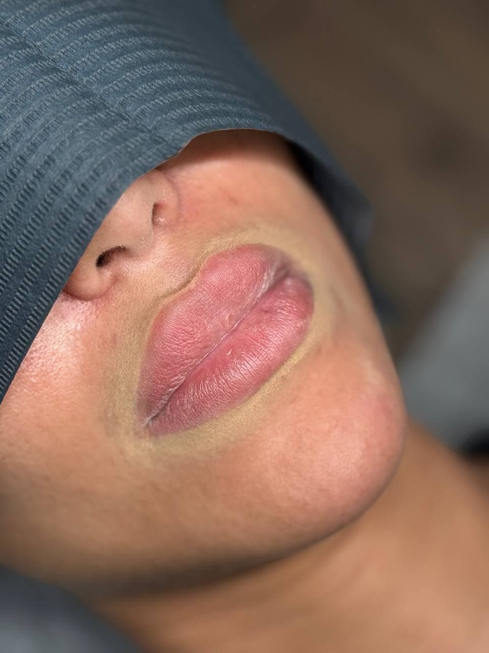 Vor der Mikropigmentierung, Majida Glam