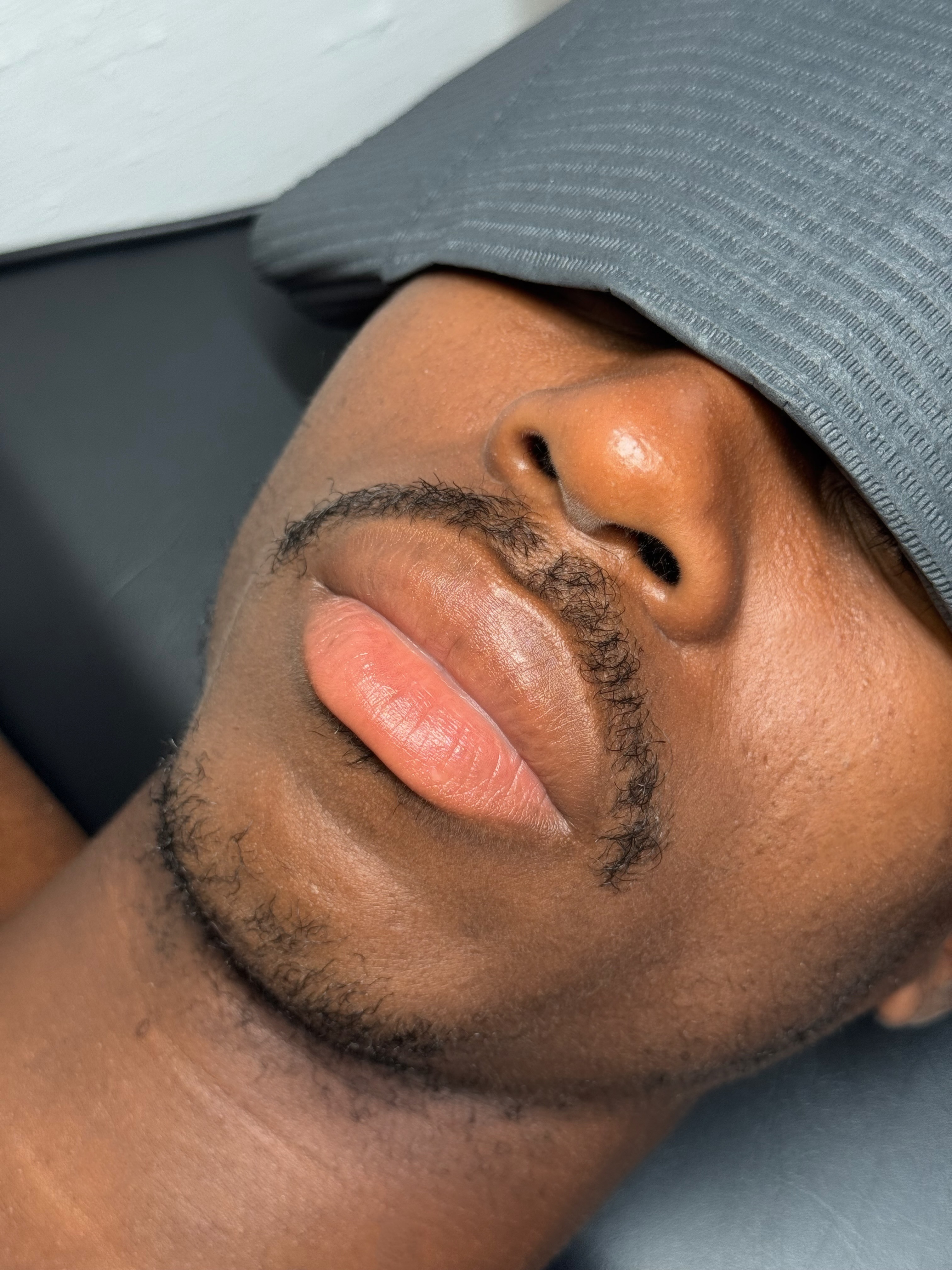 Résultat Dark Lips chez un homme au studio Majida Glam à Genève