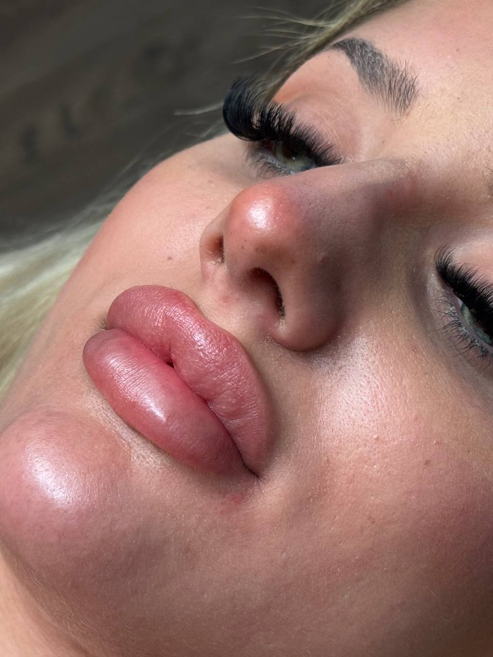 Résultat volume naturel sur lèvres fines grâce au Candy Lips au studio Majida Glam